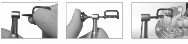 IPR Handpiece