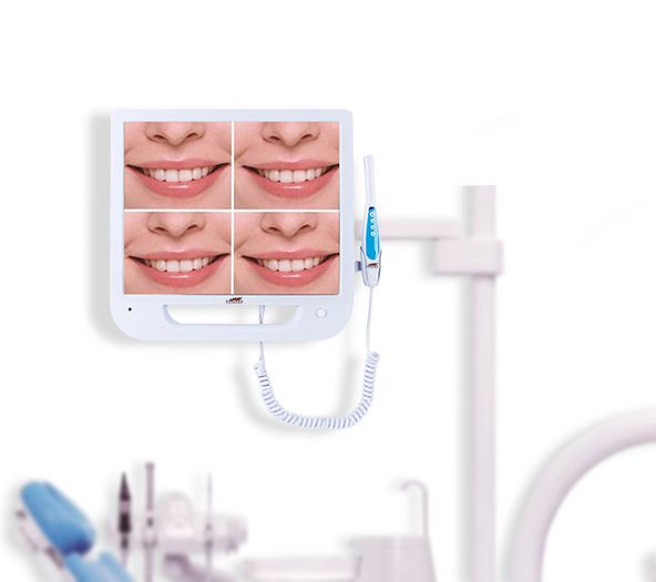 NMD Nexus Medodant  Dental  All in 1 Camera + Monitor + Holder 