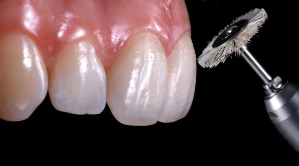 Dental Grinding Or Polishing Kits For Ceramic (35pcs/pk) For Dental Lab Use