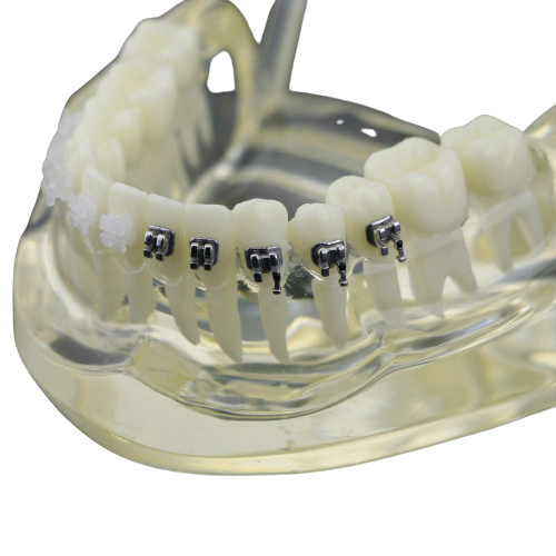 NMD Nexus Medodant Dental Ortho Half Metal/Half Ceramic Education Model Anatomical Body Model