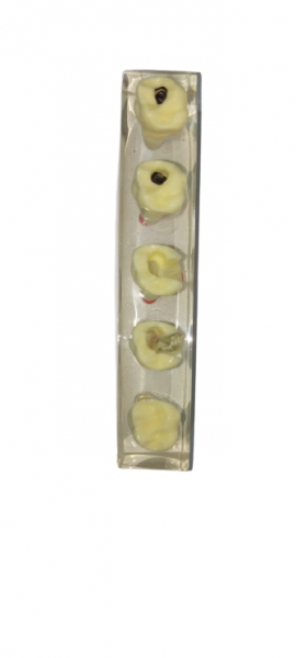NMD Nexus Medodent Dental Endodontic Demonstration Root Treatment Model with Removable Crown (Pack Of 1 Pcs)