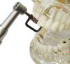 Dental Polishing Finishing Strips Orthodontic Interproximal Reduction Automatic Strips IPR Strip System