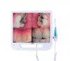 NMD Dental All in one Camera Monitor
