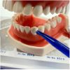 Dental Transparent Matrix Cervical Matrices (277PCS/Set)