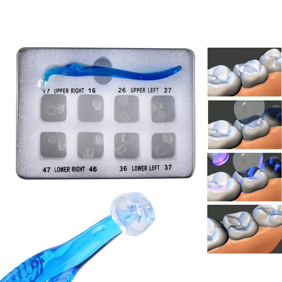 LK-E109 Composite Curing Posterior Aesthetic Teeth Printing Mold Kit -  China Posterior Aesthetic Printing Kit, Aesthetic Printing Mold